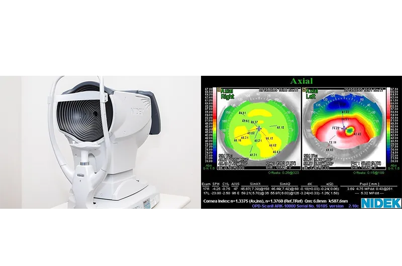 OPD（角膜形状／屈折力解析装置）