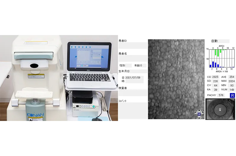 スべキュラーマイクロスコープ